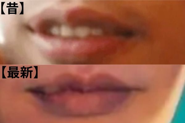 米津玄師の昔と最新の唇比較画像